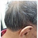 시그니아독일보청기도봉센터 이미지