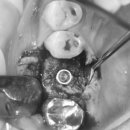 애플치과기공소 이미지