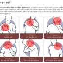 [송도 어깨 재활 PT] 라운드 숄더 통증 개선은 리버스바디에서
