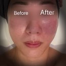 남대전신협 앞 | [대전 관저동] "끌리메 대전관저점" 끌링 작은 얼굴관리 후기