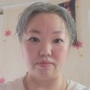 피부아지트(뉴페이스) 이미지