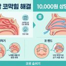 (주)유유테이진메디케어 | 작업실에 뒀더니 코가 뻥! 비염 환자들이 줄 서서 사는 가성비 아이템 TOP 3