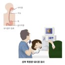 [위염증상] 급성위염 미란성위염 증상 및 치료~! 이미지