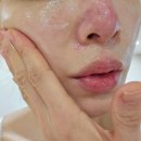 여드름화장품 :병원에서 쓰는&#34;타임인네이처 허브아이알크림 레벨1&#34;솔직후기