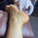새포항한마음센터 | [포항발관리] 모모두피탈모센터에서 발각질제거하고 아기발 된 후기