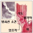 쇠비름의 놀라운효능 이미지