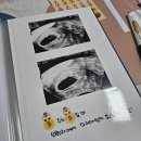 어울림산부인과의원 | [임신 중기/12주~28주] 주수별 증상 및 기록(입덧, 갑상선자극호르몬 수치 이상, 관절통증, 태동, 양수량)