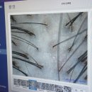 메소드짐 | 송파두피관리, 두피도 PT받자｜WT메소드 송파점 에어필 파워스케일링 후기