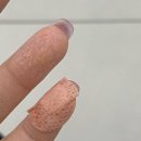 대창면보건지소 앞 | 방배] 내가 고혈압 전단계!?, 대사증후군 상담 후기 (feat. 방배 보건지소, 대사관리증후군 관리 센터)