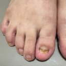 채이네일 이미지