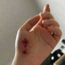 개포삼성정형외과의원 이미지