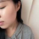 아현 | 마포피부과 온다리프팅후기 아현역피부과에서 턱선 고민 해결 시작해본 리프팅 경험