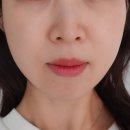 (주)하인지 | [뷰티디바이스비교] 홈쎄라 &amp; 하이포커스샷 내돈내산 후기