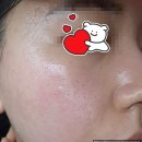 씨유 웅천비고시티점 | [여수 뷰티따듯] 웅천 피부관리샵 피부 에스테틱 추천 (여수/여천/웅천)내돈내산 솔직후기