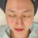 베니히룸 | [경기도 안양] 베니히룸 플라즈마 트러블 큐어 관리 후기