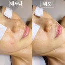 우리은행 서초동 제1합숙소 | 서초동 피부관리 에스테틱 탄력고민 교대역 압출 feat 바오뜨
