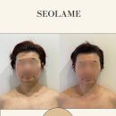설아미 | 의정부윤곽관리 설아미 의정부본점 다녀온 솔직 후기 (윤곽부터 피부, 바디까지 한 번에 관리되는 느낌)