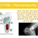 상봉알즈너