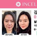 인셀덤하다 네이버블로그