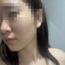 휴먼파워 | 피부관리] 건대역 피부관리 한여울에스테틱 파워리프팅 후기, 30대 직장인 턱살 리프팅 관리 받고 온...