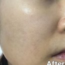 지비아이앤씨 | 스파이더펩타이드 헤븐리터치 에센스로 쫀쫀하게