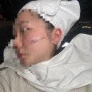 제주스킨플래닝 전문샵 “오브먼트 스튜디오” 세라링 후기