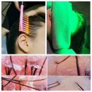 수성구두피관리 멋진인생에스테틱두피센터 황금점 방문후기
