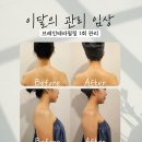 [공유] (💸내돈내산💸) 방배동 위드에스테틱에서 브레인 테라필링 관리 받고 온 후기