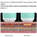 신길연세365의원 | 영등포 바디슈링크] 다이어트 후 처진 살 고민? 신길연세365의원 슈링크 유니버스 바디 리프팅으로 해결!