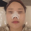 청주 스킨플래닝 잘하는 곳, 루커샵 스킨플래닝 후기