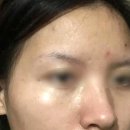 더맑은약국 | 약국 멜라노사크림 후기 처방 가격 기미잡티 제거 효과 사용법