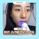 3 | 내돈내산 피캄 클리어프로 3개월 사용후기 사용전후 차이