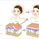 엘라스틴미아사거리역