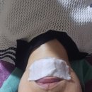 모델링클럽 | 연남동피부관리 홍대뷰티클럽 여드름압출 피지관리 후기
