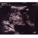 대흥중학교 | [임신일기] 시흥시보건소 임신부 뱃지 발급받은 후기입니듀