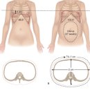 비버스필라테스 이미지