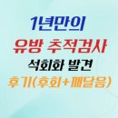 군집 | 유방 석회화 (군집형) 조직검사 후기