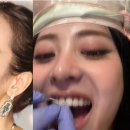 투스 이미지