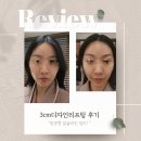 엠케이 | 성신여대피부관리 리프팅 후기 엠케이에스테틱 mk듀얼디자인리프팅(3cm) 직접 받아봤어요