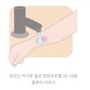 푸른병원 | 제주 화상 병원: 제주푸른병원 치료 후기 및 화상 응급처치 꿀팁 (제주살이 중 비상사태!) 🏥