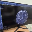 진황도로 61길 | 보훈공단 중앙보훈병원 방문 양성 뇌종양 수술 예약