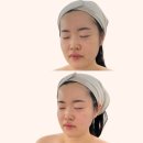 이뻐진개 | 대전 피부관리 아로뮤에스테틱 윤곽관리받고 얼굴라인 이뻐진 찐후기