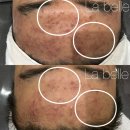 라 벨르 에스테틱 이미지