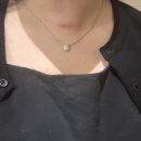 갑상선 절제술 2회 후 /레이저 치료 + 주사치료 상담후기 /수서오체안피부과후기