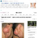 에스트로겐과 비염과 젖산 근소포체 근육이완 홍보대상들 안꺼지네? , 기괴하신 모양들 음경들보소 이미지