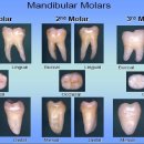 로우 어금니(대구치?) 사진(Mandibular Molars) 이미지