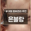 씨유구미형곡시장점 | [구미 피부관리 은블랑] 자극 없는 수분관리부터 플라즈마까지 제대로 받고 옴!