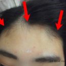 킴스헤어라인 이미지