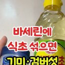 바ㅛㅔ린에 식초 검버섯 지워짐 이미지