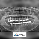 태양치과기공소 이미지